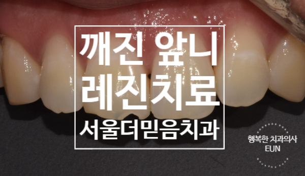 수지좋은치과의원 이미지