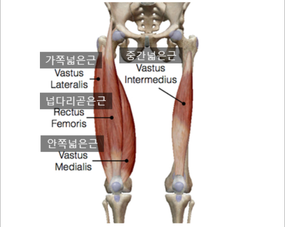 킹스3 이미지