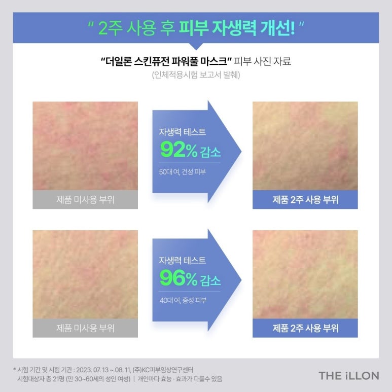 상상스킨케어 이미지