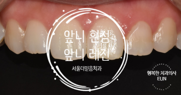 수지좋은치과의원 이미지