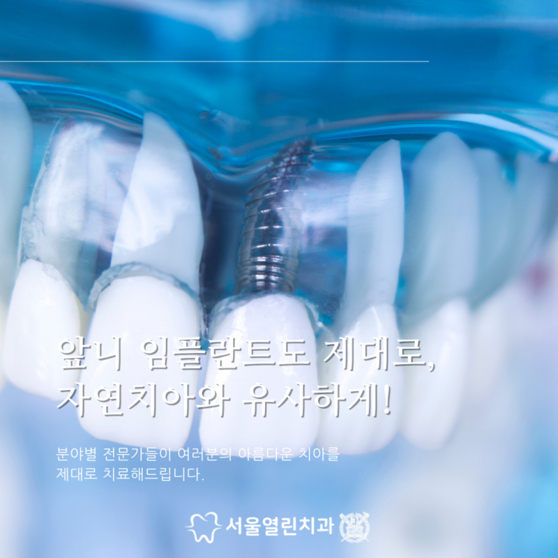 서울열린치과 이미지