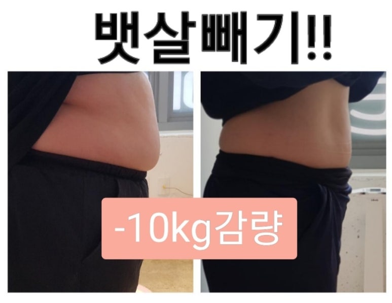 라온핏 이미지