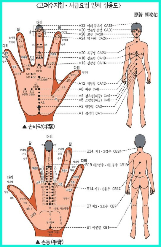 고려수지침요법학회 이미지