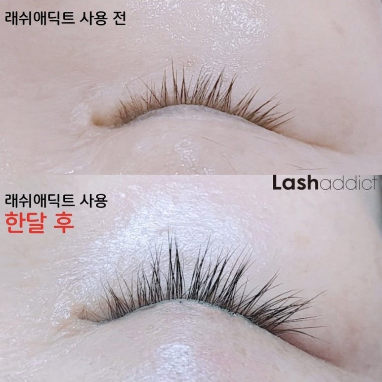 리얼래쉬 이미지