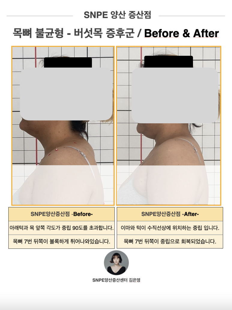 등뼈가 양산증산점 이미지