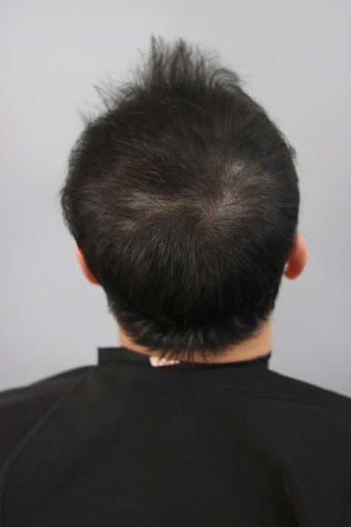 스칼프디자인센터 이미지