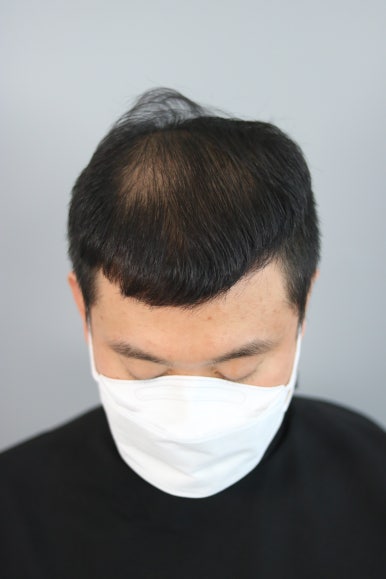 스칼프디자인센터 이미지