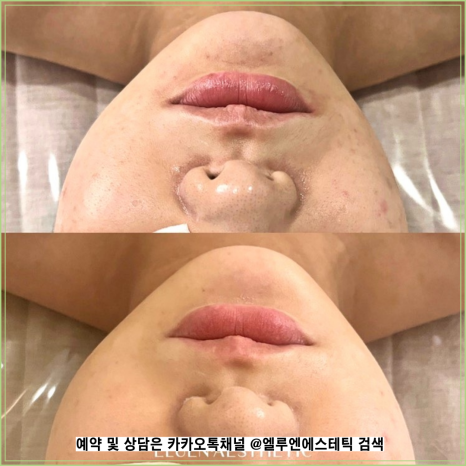 함에스테틱 이미지