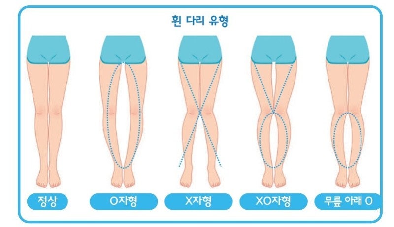 에스제이체형교정 이미지
