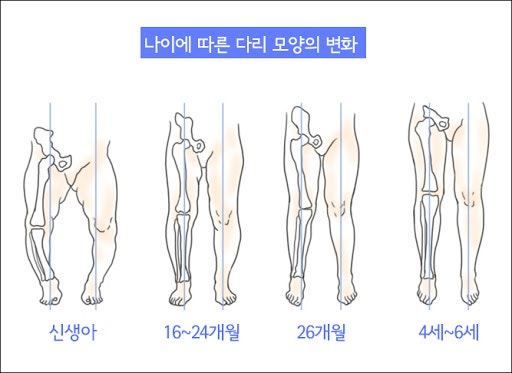 에스제이체형교정 이미지