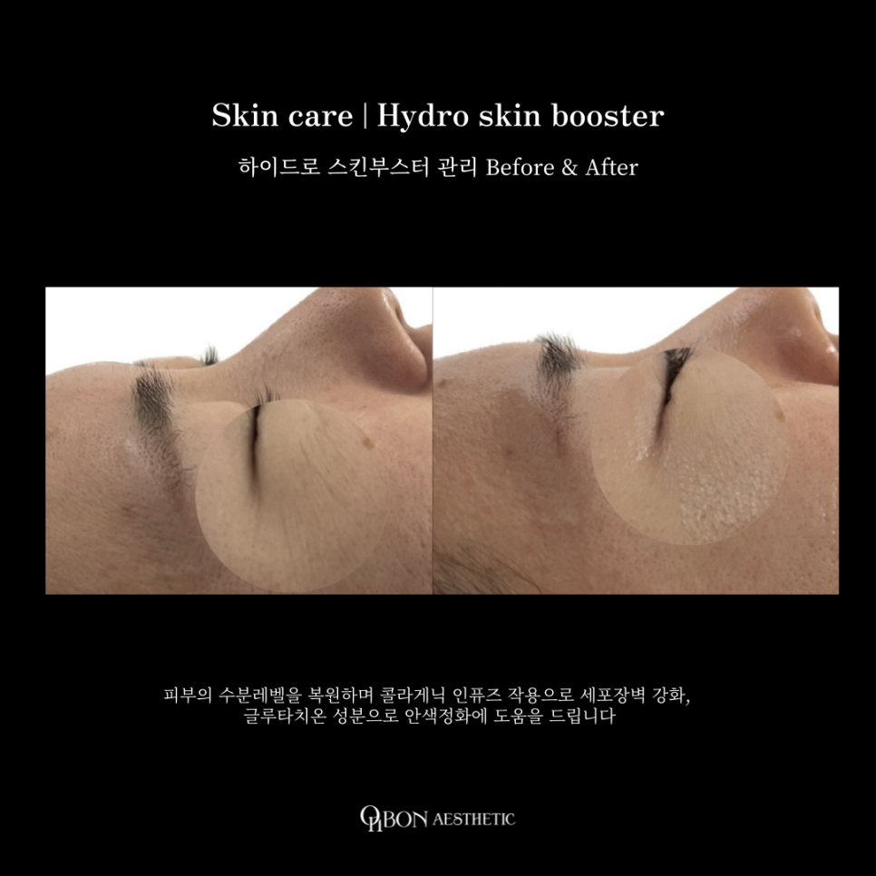 온본에스테틱 평택점 이미지