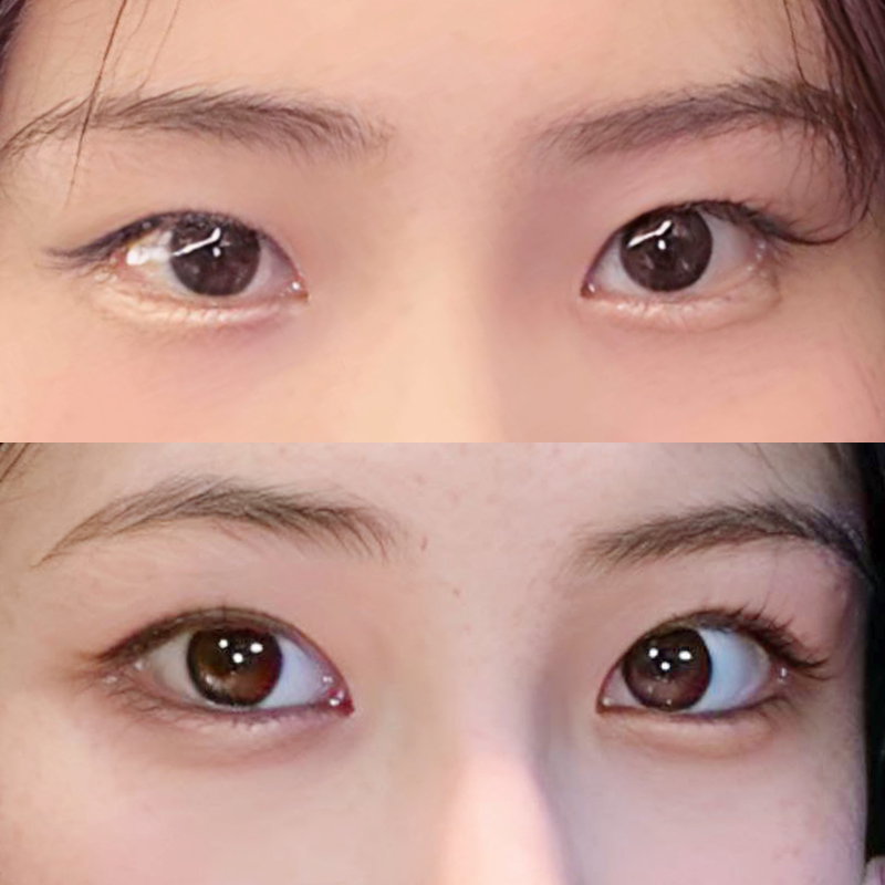 더웨이성형외과 이미지