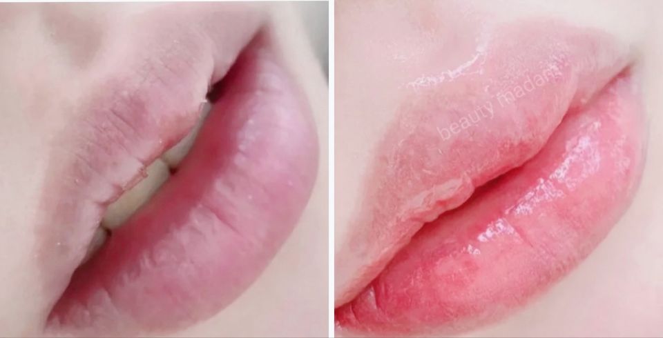 뷰티마담 이미지
