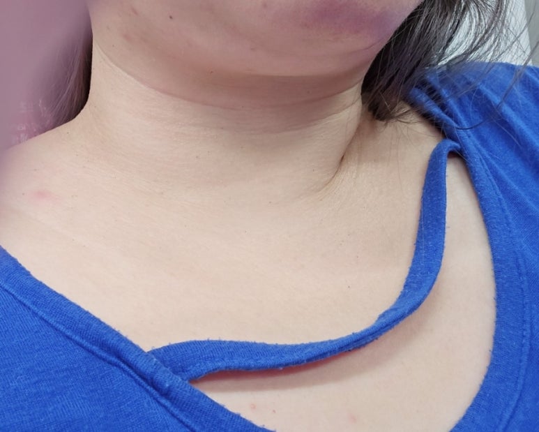송석초데이스파살롱 이미지