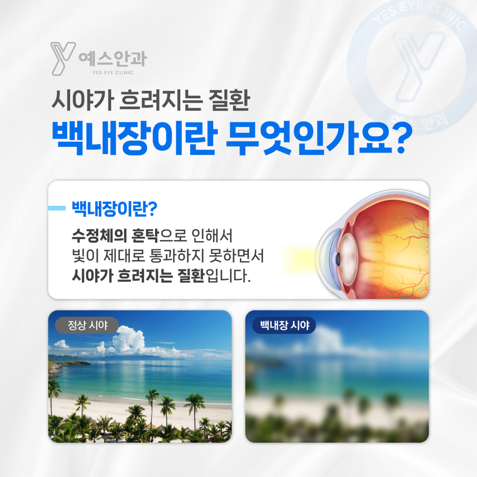 예스안과 이미지