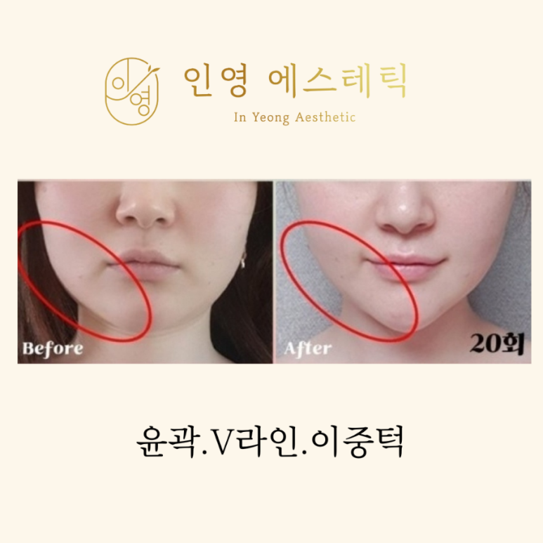 인영#샵 이미지