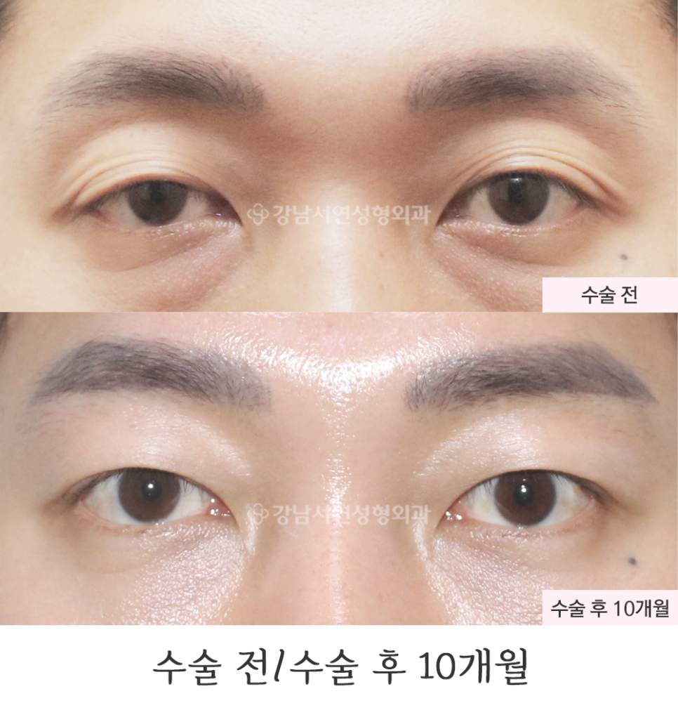 서연성형외과의원 이미지