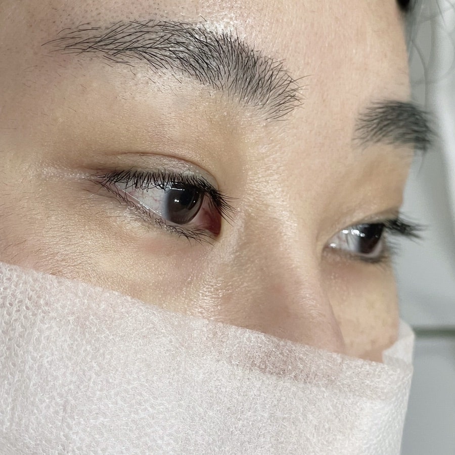 하이.롬블리 이미지