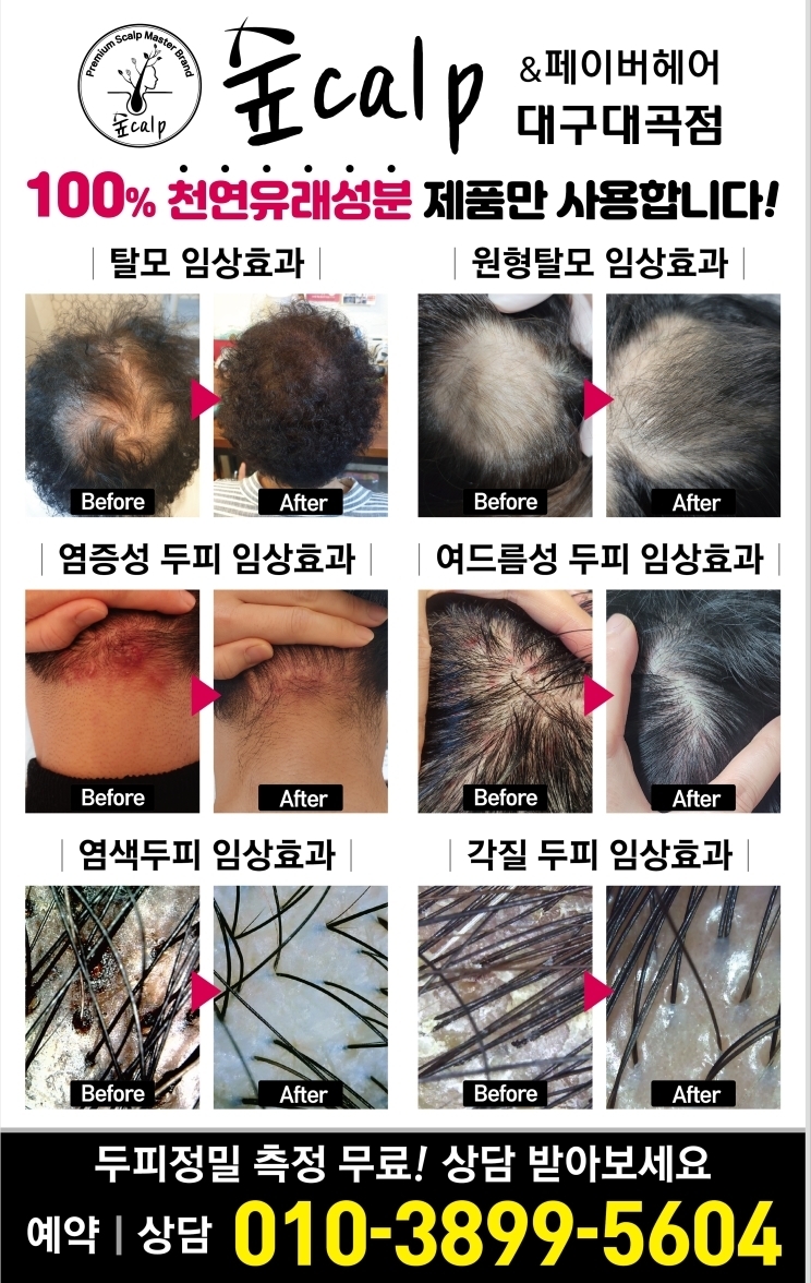 페이버헤어 이미지