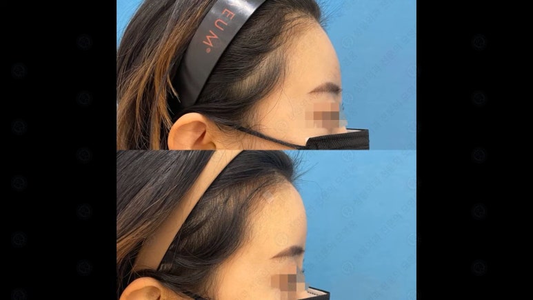 신촌홍대라마르성형외과의원 이미지