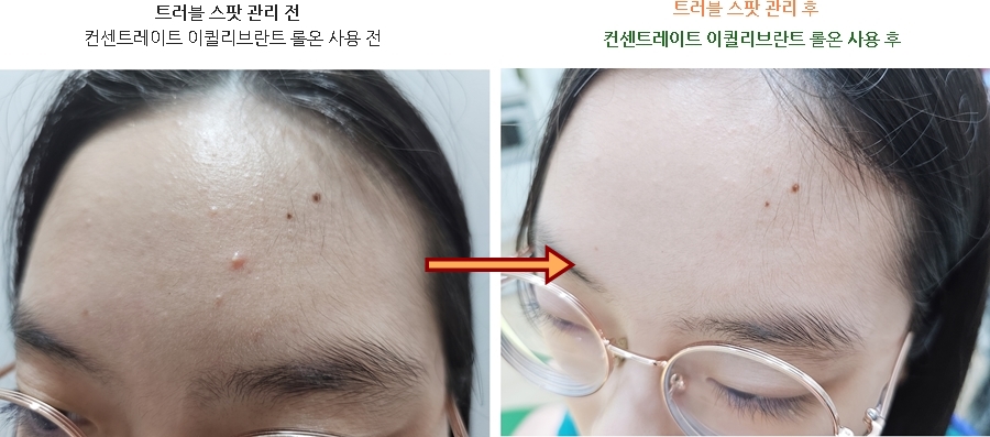 아누비스에스테틱 이미지