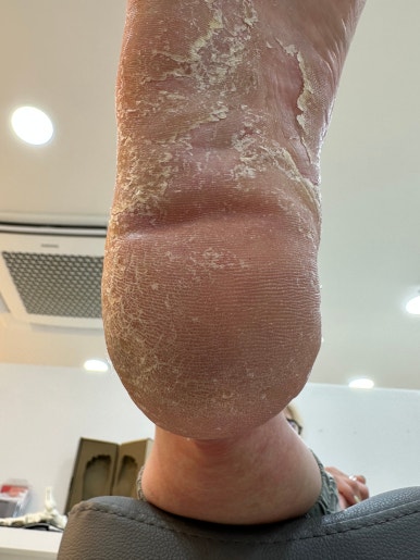 치유네일레푸스 강릉교동점 이미지