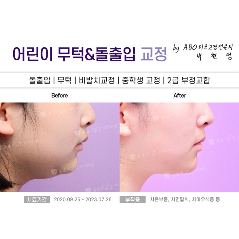 서면뉴욕치과의원 이미지