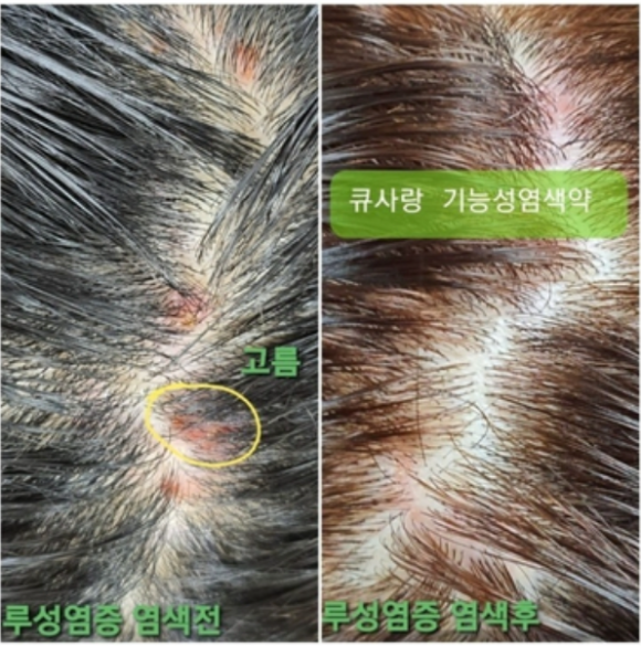 큐사랑머리염색 이미지