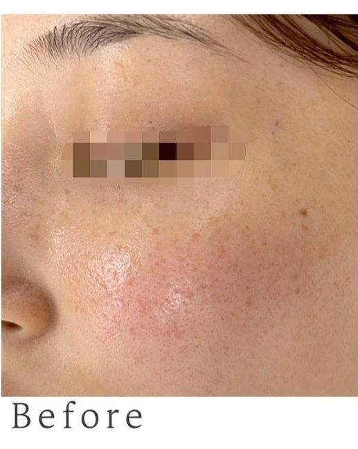 왁싱데이스킨케어 이미지