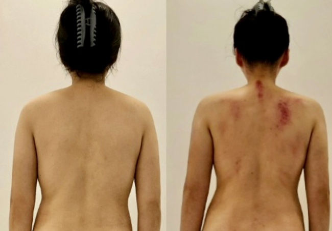 허치벨 이미지