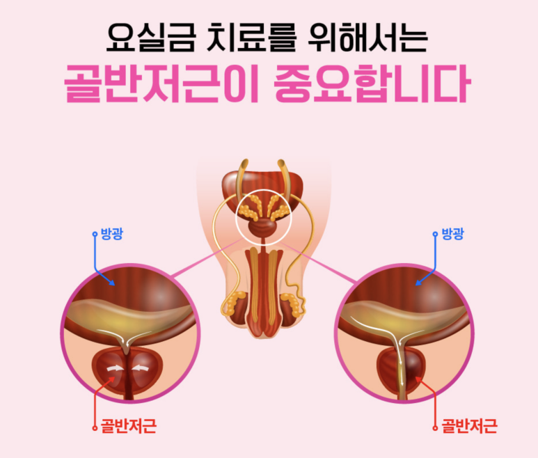바디닥터2 이미지