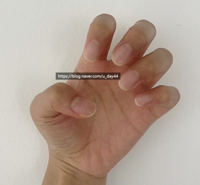 RIMS NAIL 이미지