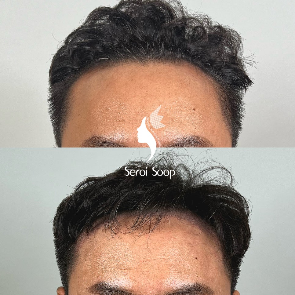 다루헤어 이미지