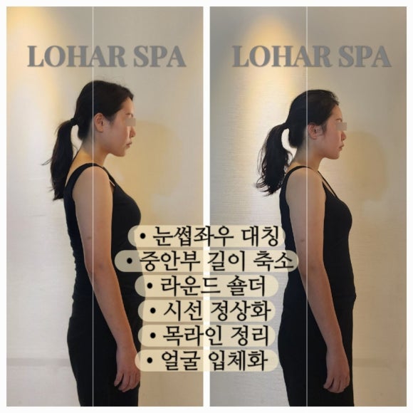 로하르스파 이미지