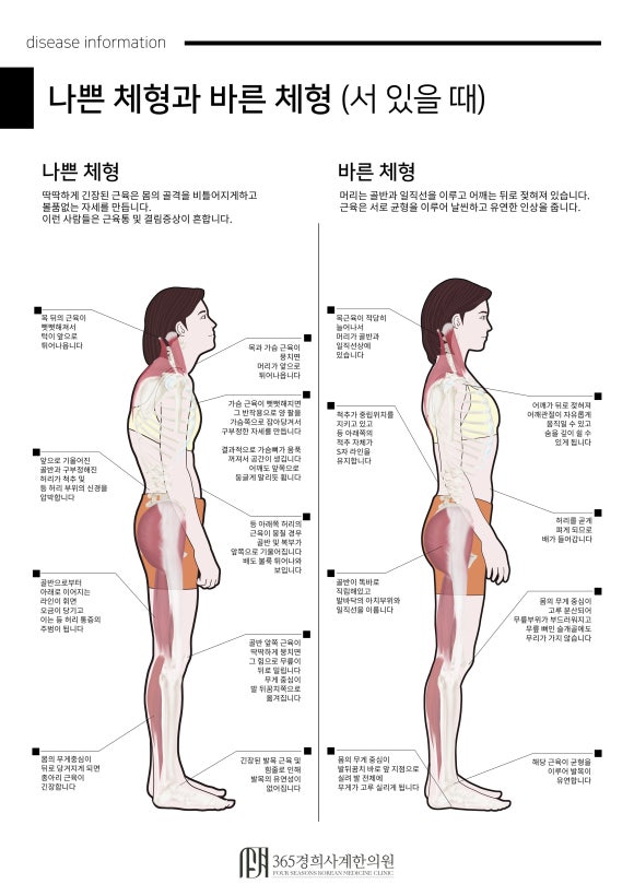 바른체형 이미지