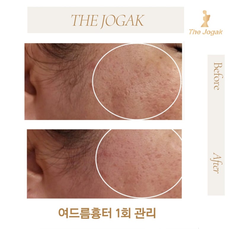 더조각테라피 이미지