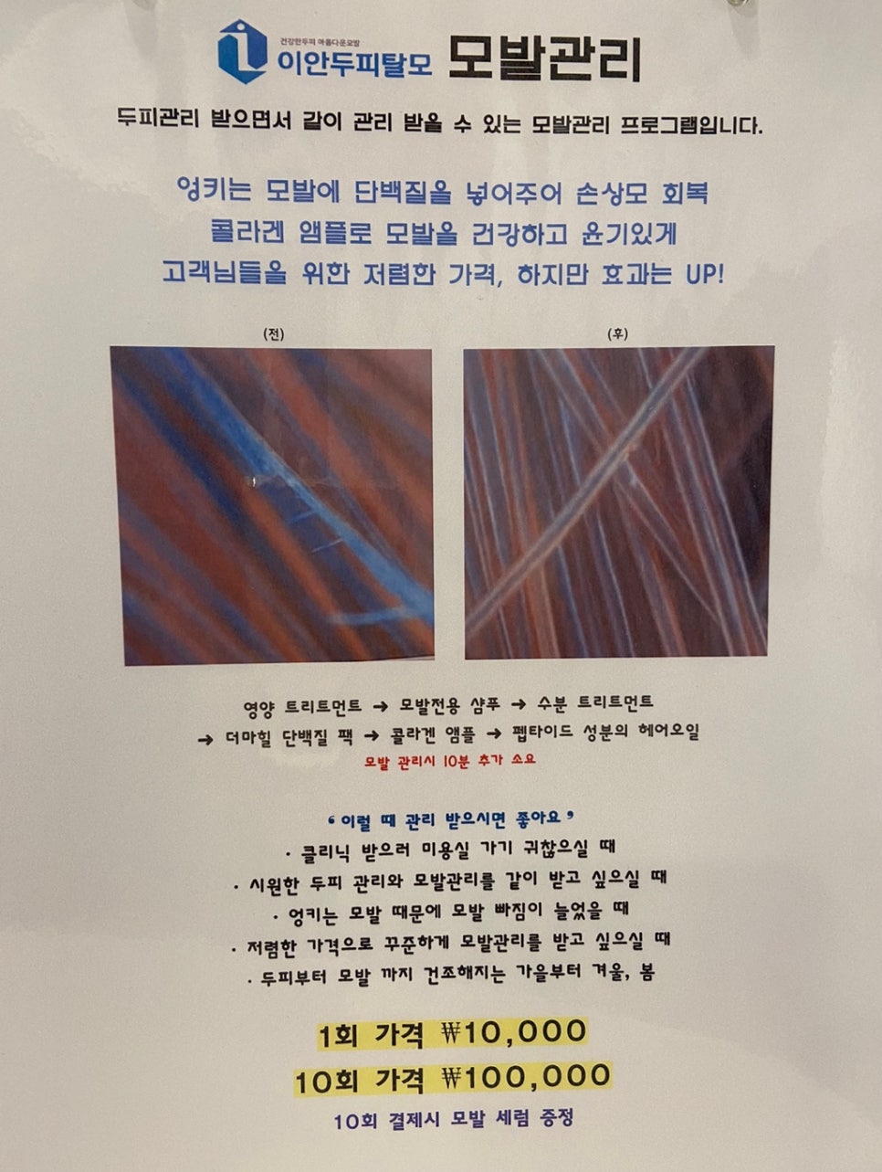 이안두피탈모 이미지