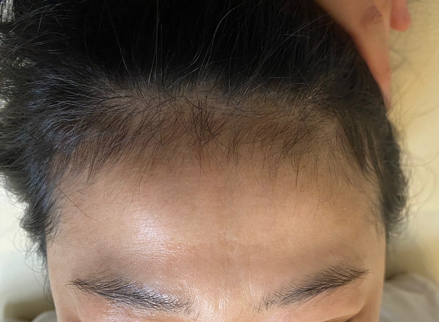 왁싱데이스킨케어 이미지