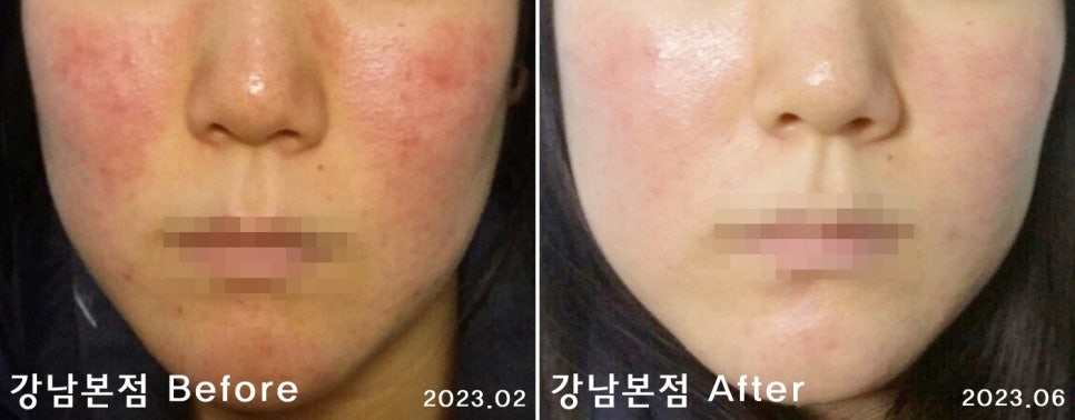 리유한의원 이미지
