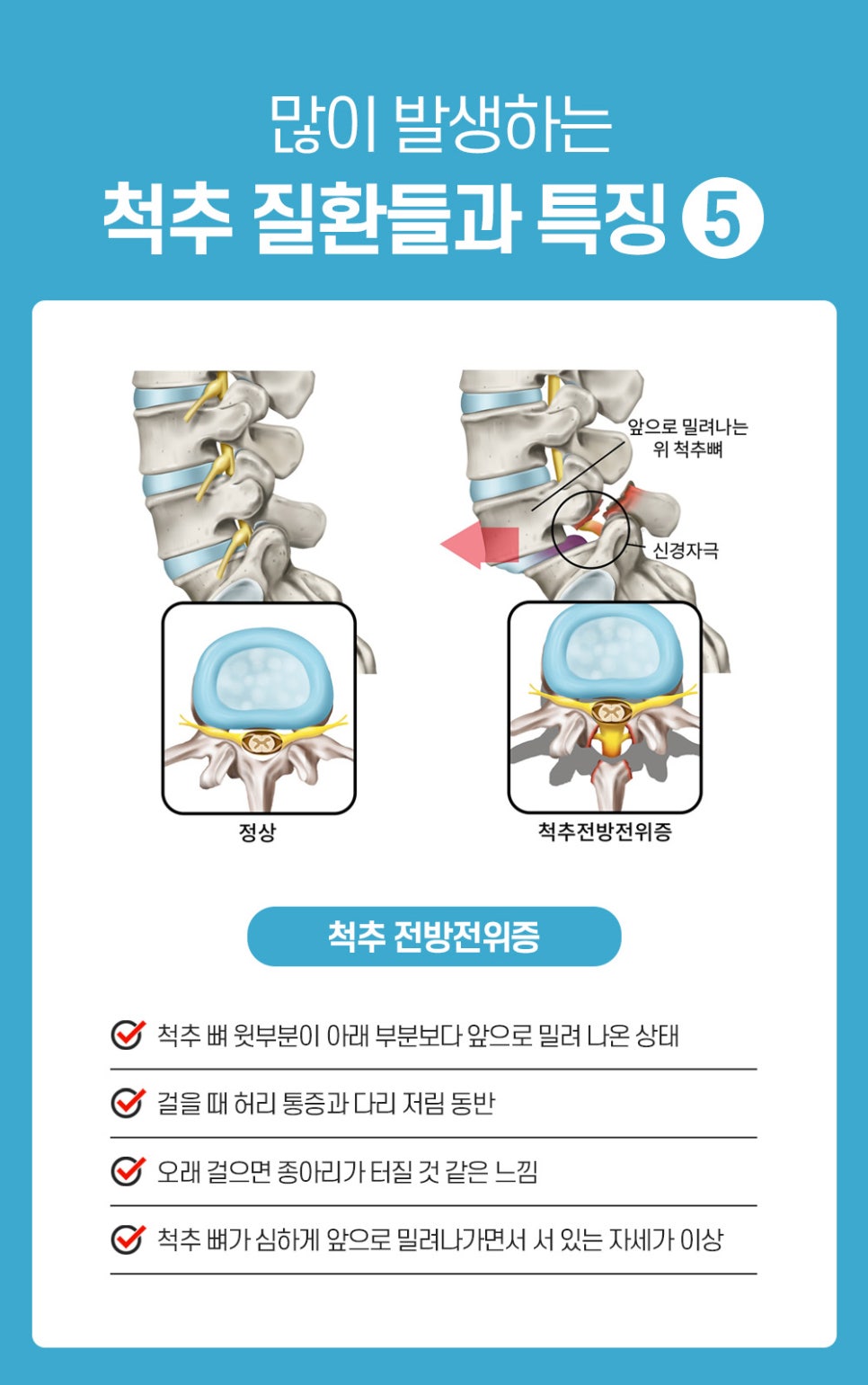 바른체형척추관리 이미지