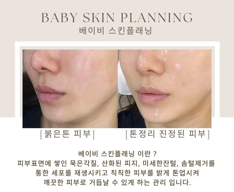 베이비스킨(baby skin) 이미지