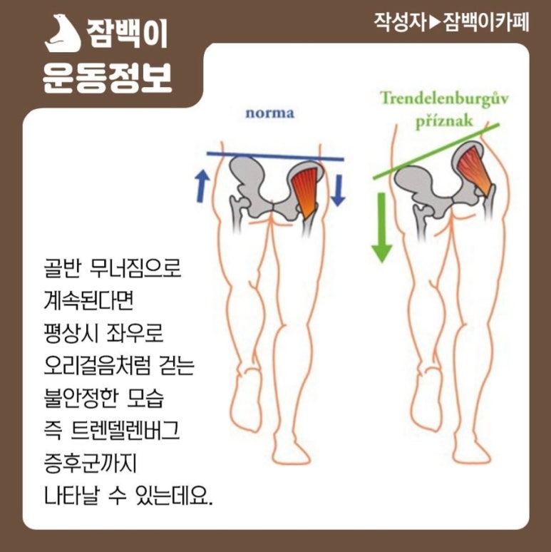 잠백이 이미지