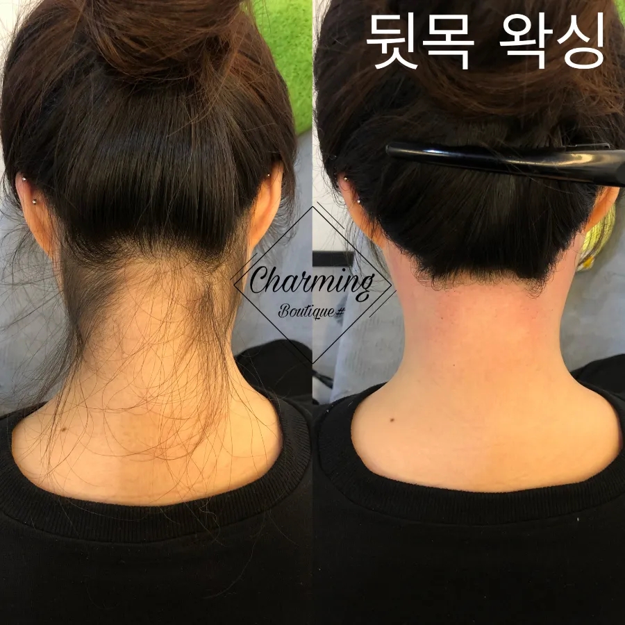 챠밍헤어라인 이미지