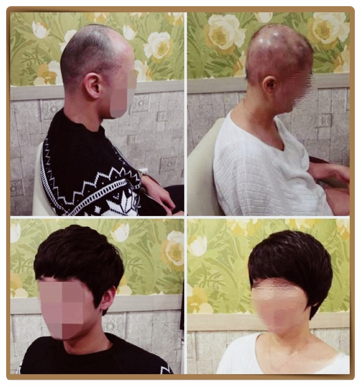 전주동안가발 이미지