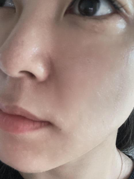 상분이스킨 이미지