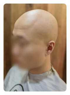 전주동안가발 이미지