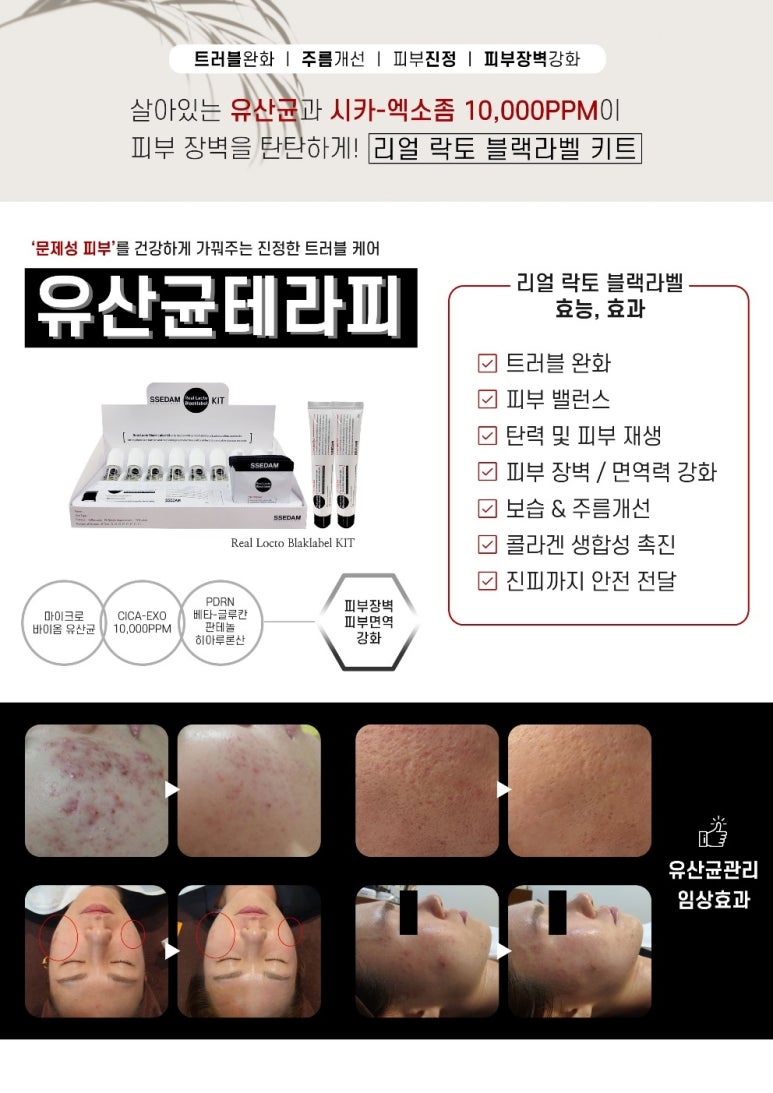 라벨테라피 이미지