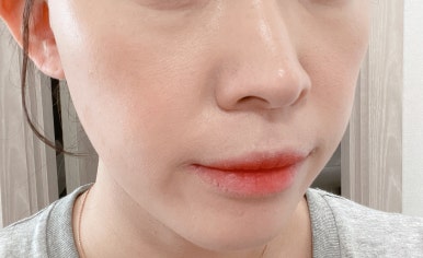 아름다운미의원 이미지
