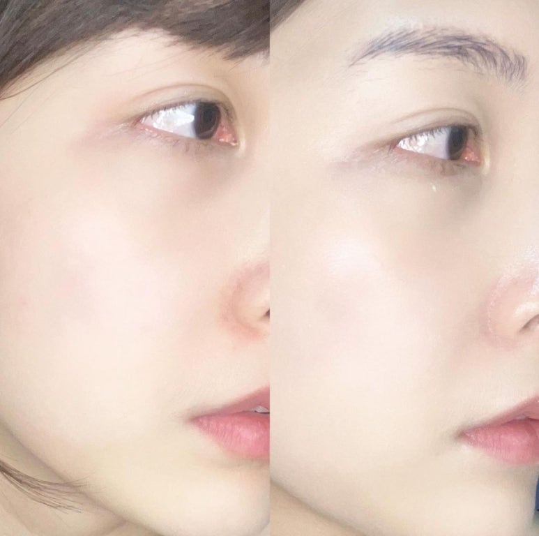 라온카케어 이미지