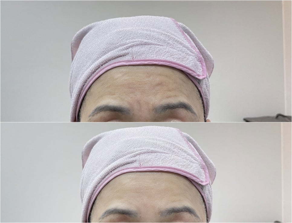 예인피부관리 이미지